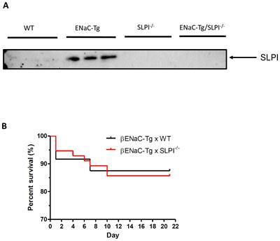 SLPI deficiency alters airway protease activity and induces cell recruitment in a model of muco-obstructive lung disease